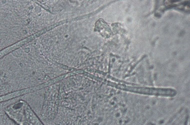 Diagnosis Management Foliar Diseases 12 - Diagnosis and Management of Foliar Diseases in the United States