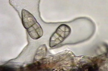 Diagnosis Management Foliar Diseases 16 - Diagnosis and Management of Foliar Diseases in the United States