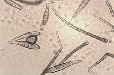 Diagnosis Management Foliar Diseases 7 - Diagnosis and Management of Foliar Diseases in the United States